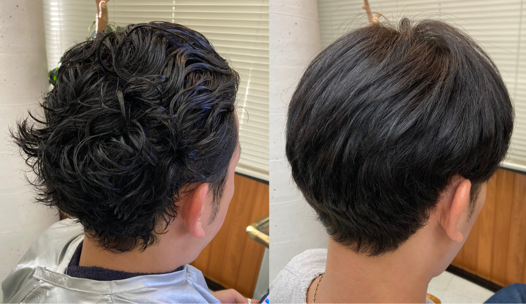 エアーストレート・メンズ施術事例