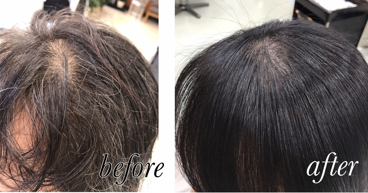 ノンジアミン・過酸化水素水不使用の白髪染め「輝髪ザクロペインター」施術事例