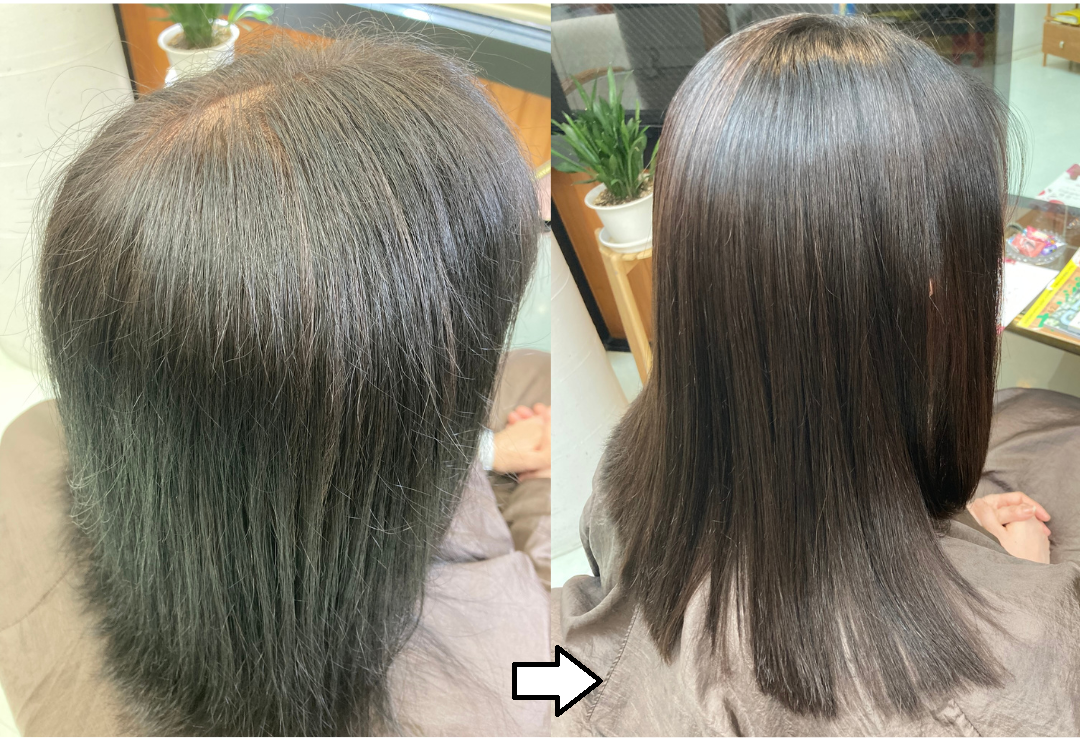 ノンジアミン・過酸化水素水不使用の白髪染め「輝髪ザクロペインター」施術事例