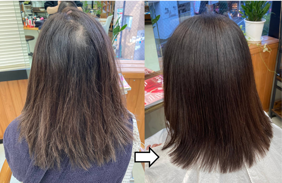 エアーストレート＆ザクロペインターによる「加齢毛改善」事例