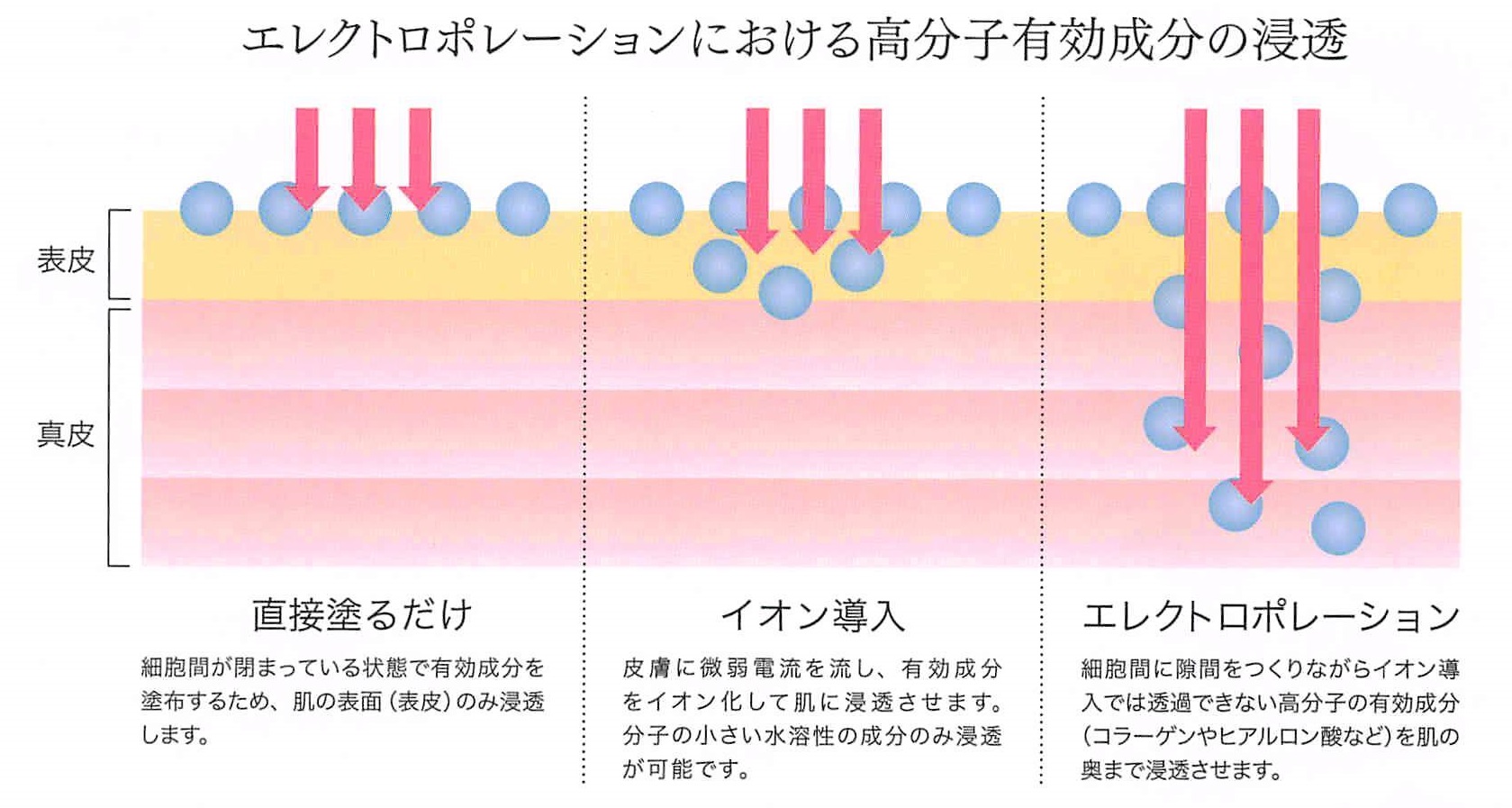 【強髪プログラム】 eポレーション プレミアムの浸透効果